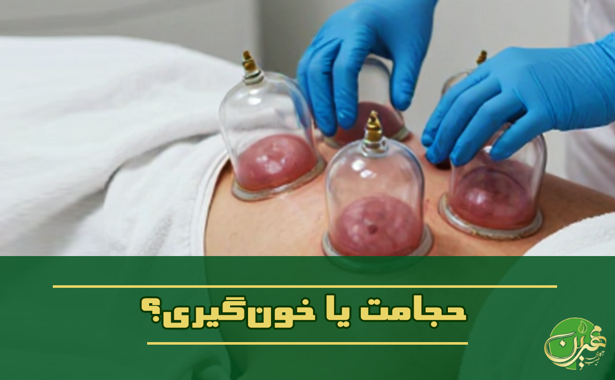 حجامت یا خون‌گیری؟ مرز باریک میان درمان اصولی